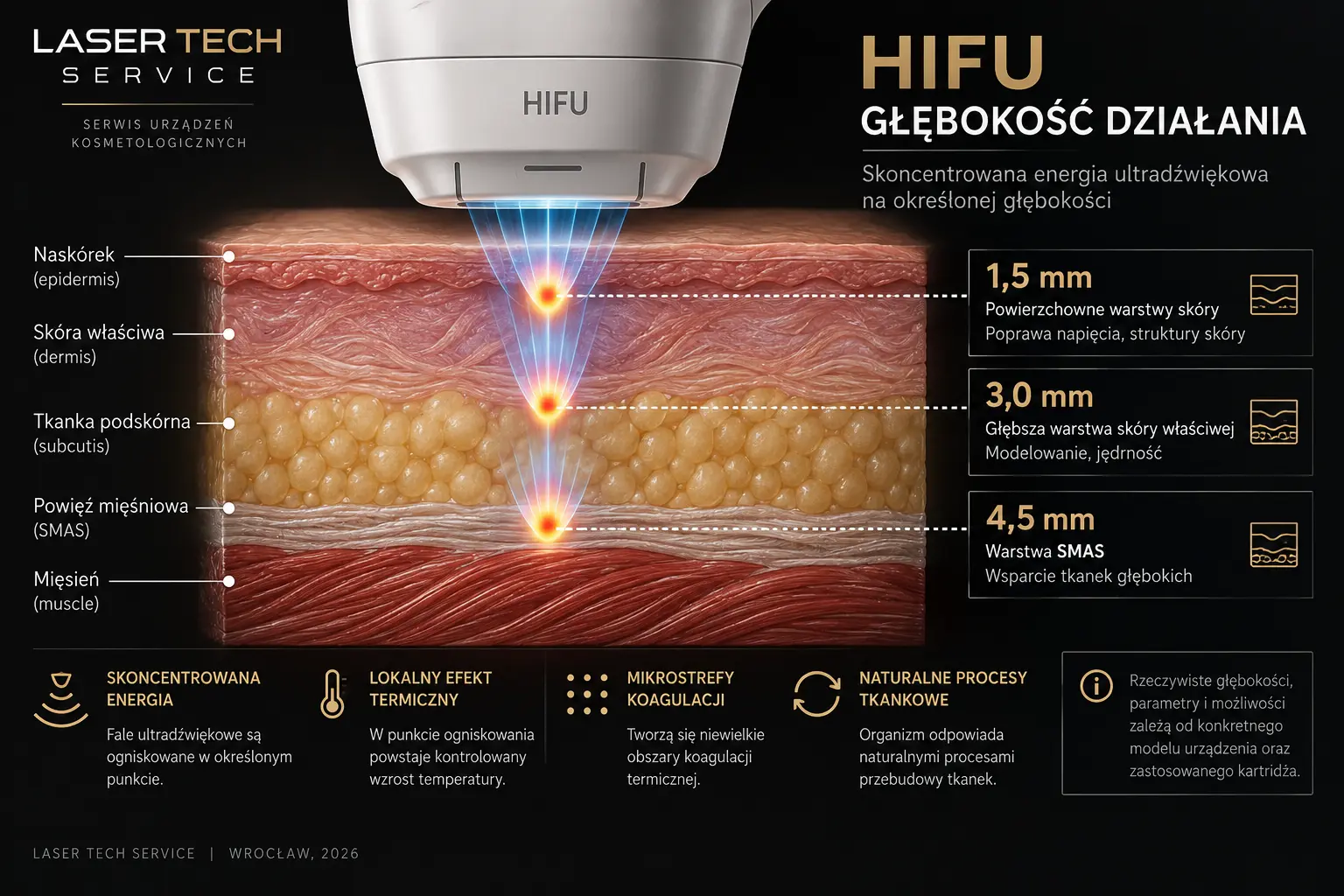 Схема работы HIFU — глубина 1,5 мм, 3,0 мм и 4,5 мм