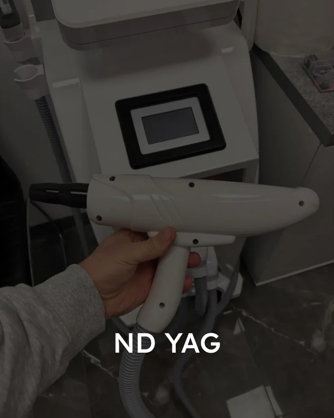 Nd:YAG laser with a treatment handpiece